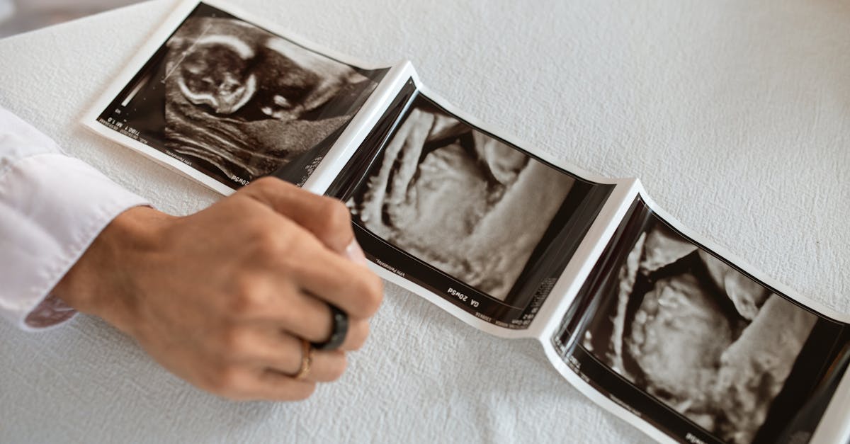 découvrez tout ce qu'il faut savoir sur les tests de grossesse : comment ils fonctionnent, quand les utiliser et leur fiabilité pour confirmer ou infirmer une grossesse.