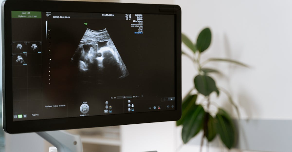 découvrez les étapes fascinantes du développement fœtal, de la conception à la naissance. explorez les merveilleuses transformations qui se produisent dans le corps humain et comprenez les processus clés qui soutiennent la vie dès ses débuts.