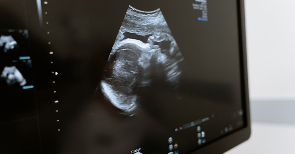 Échographie : tout ce que vous devez savoir sur cette technique d’imagerie médicale