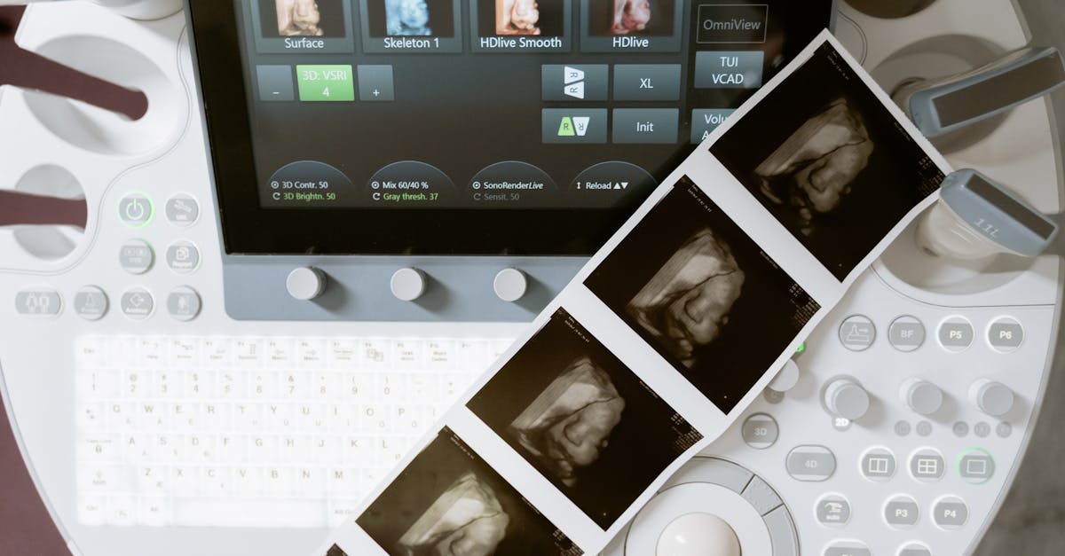 Suivi de grossesse : conseils pour une surveillance optimale de votre santé